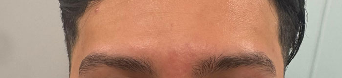 after-before-13-1