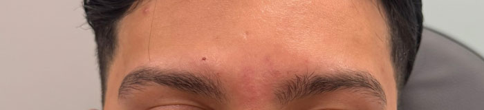after-before-13-2